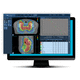 treatment planning software / radiology / for radiosurgery treatment planning / for tablet PC