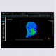 medical imaging PACS