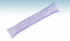 duodenal stent