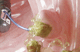 stone extraction catheter / biliary / balloon / 7 FR