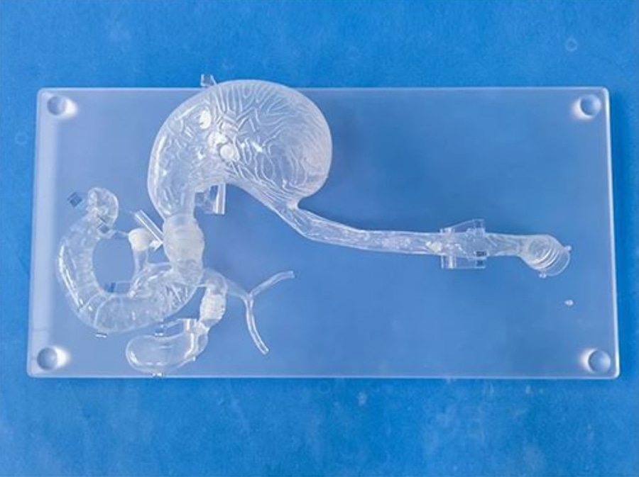 What is the use of ERCP in training operations? Ningbo, Zhejiang