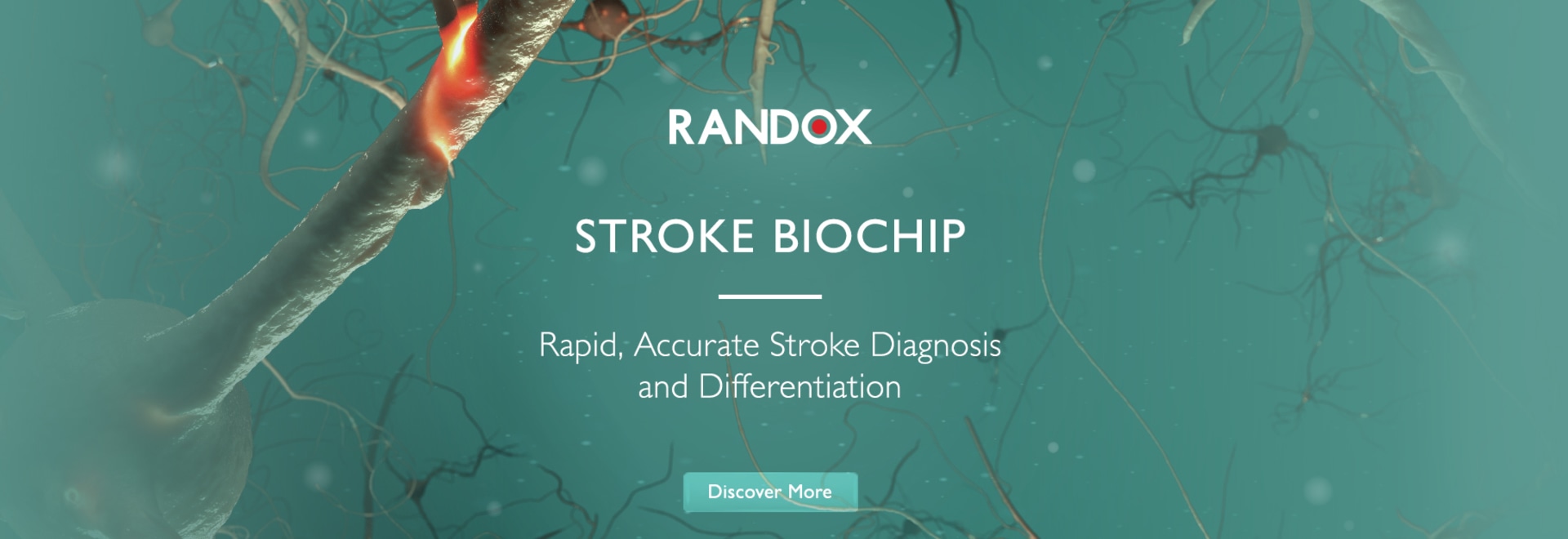 Introducing the Randox Stroke Biochip - 55 The Diamond Rd, Crumlin BT29 ...