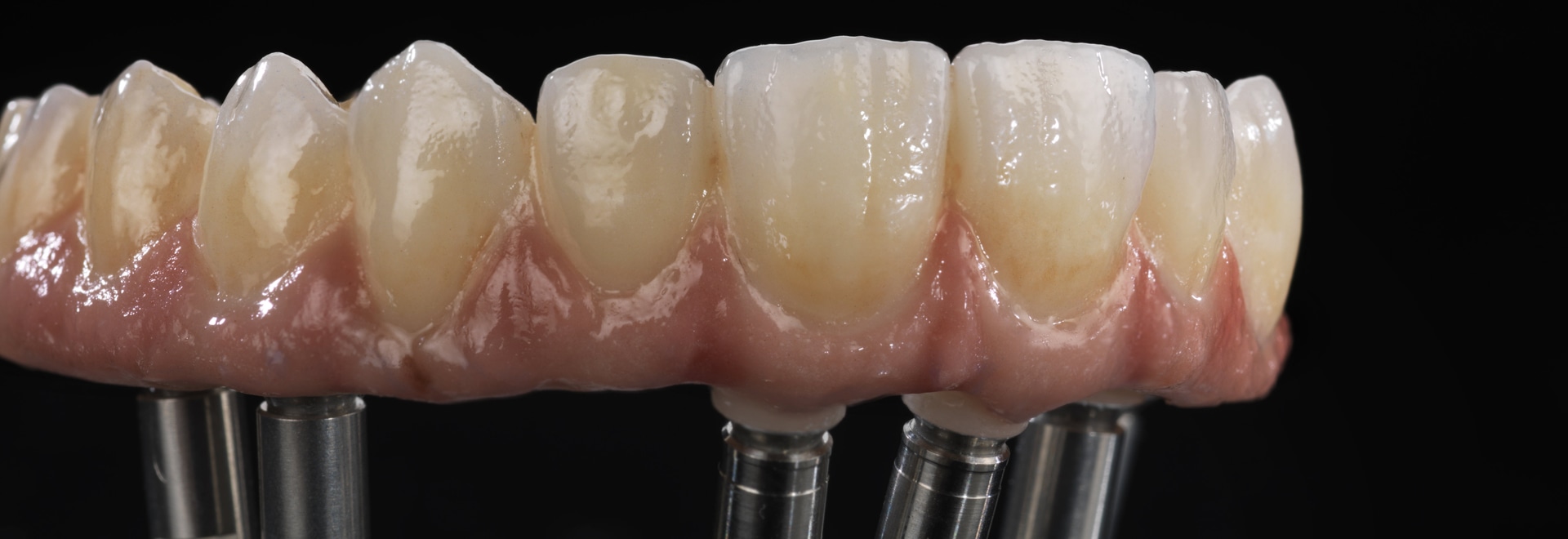 Ceramill Zolid HT+ - Herrschaftswiesen, 6842 Koblach, Austria - Amann ...