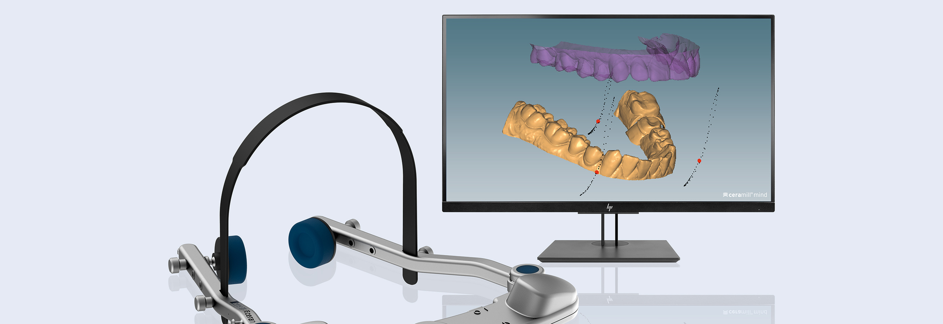 Functional digital virtual facebow completes CAD/CAM workflow