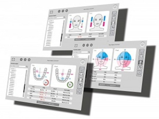 Dental Occlusion Scan Within 3 Minutes