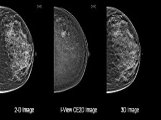 Mammography’s 3D Future