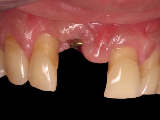 Figure 14