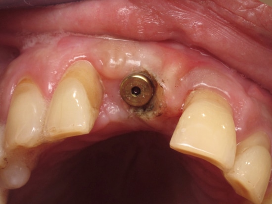 Figure 15