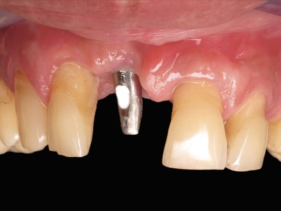 Figure 16