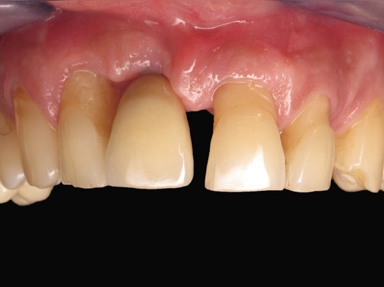 Figure 17