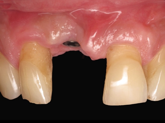 Figure 18
