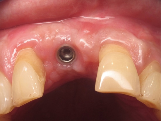 Figure 19