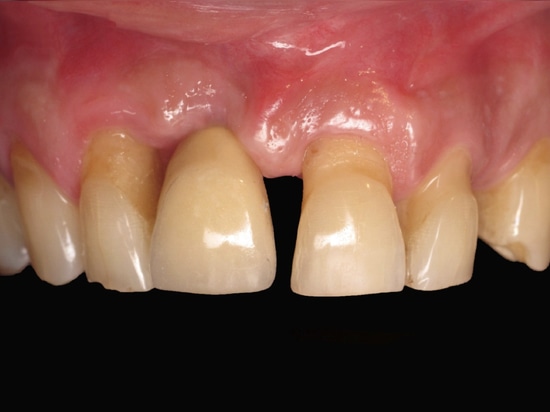 Figure 20