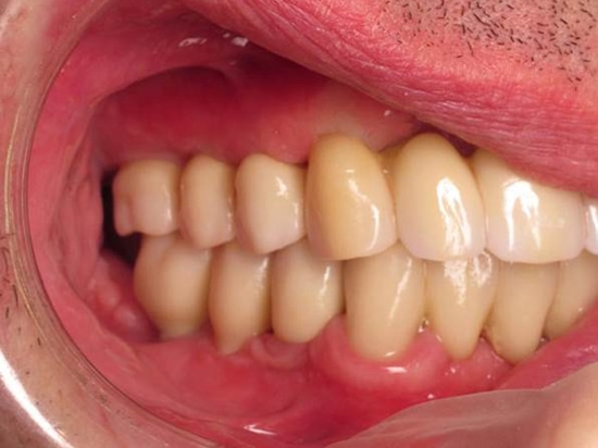 Fig 10.