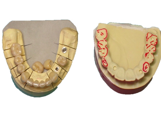 Fig 13.