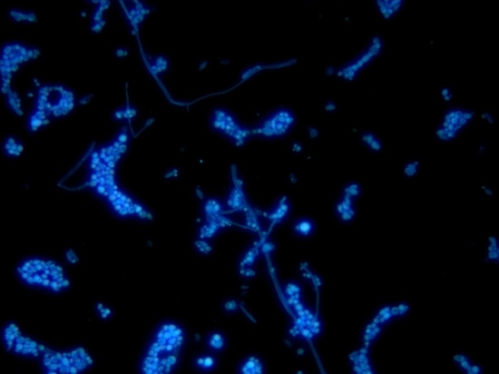 Fungis under fluorescence microscope