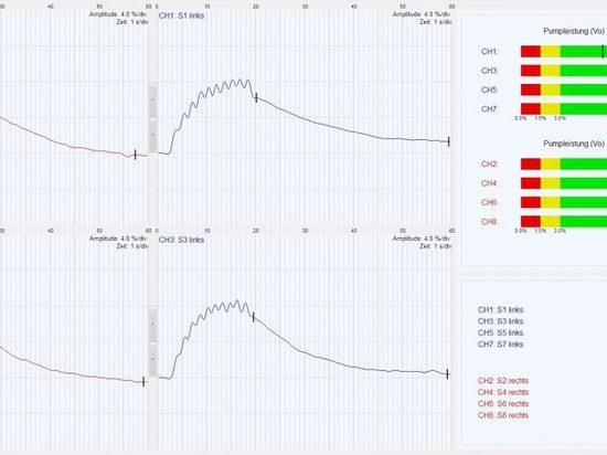 The latest generation of D-PPG/LRR systems