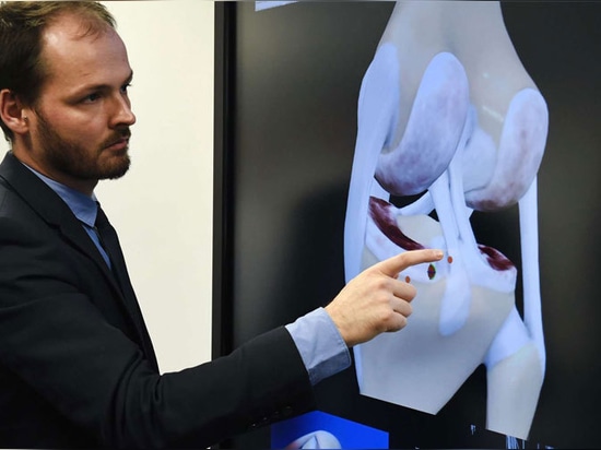 New French Bio-Printed Knee Prosthesis