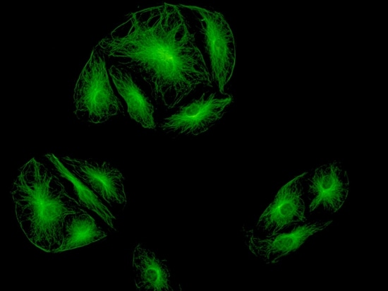 Cells dye by FITC under fluorescence microscope