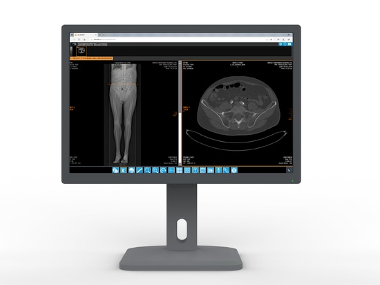 Estone launched new product - DICOM series