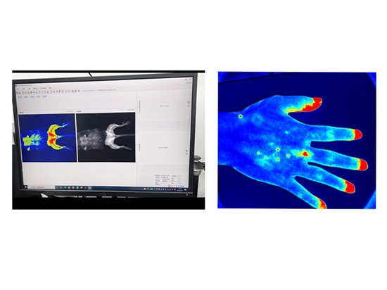 blood flow imaging