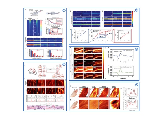 The Third Generation Laser Speckle Imaging System RFLSI-ZW is Coming Out Soon