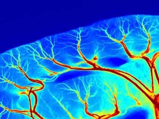Detailed Introduction of RFLSI ZW Laser Speckle Contrast Imaging System
