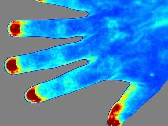 Detailed Introduction of RFLSI ZW Laser Speckle Contrast Imaging System