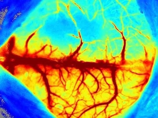 Detailed Introduction of RFLSI ZW Laser Speckle Contrast Imaging System