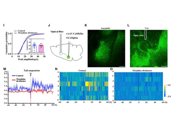 Application of Fiber Photometry in the Study of Neurological Disorders