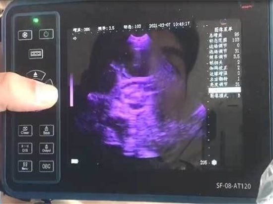 Veterinary Ultrasound Pseudo-Color