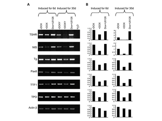 The relationship between thyroid cancer and BRAF gene