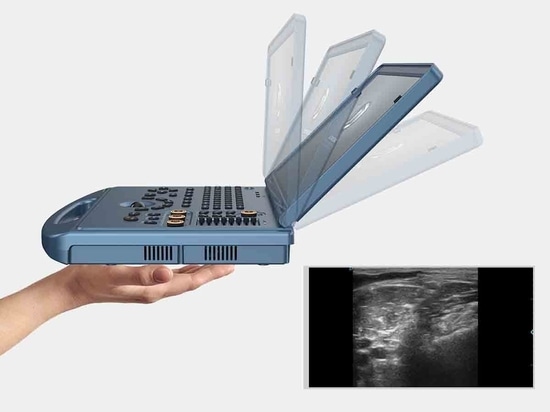 MSK Ultrasound Machine for Sale - Jin Qiao Lu, Gu Lou Qu, Xu Zhou Shi ...