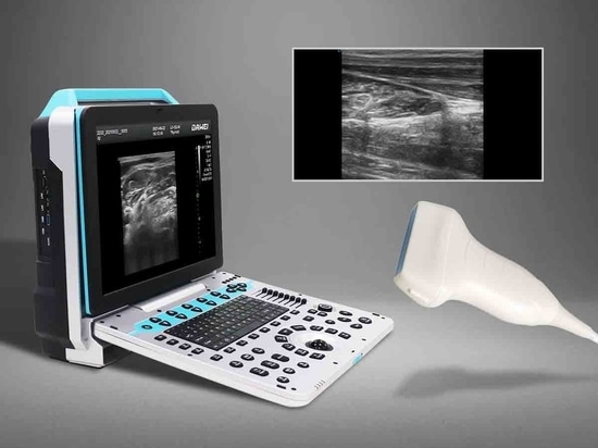 portable color ultrasound machine