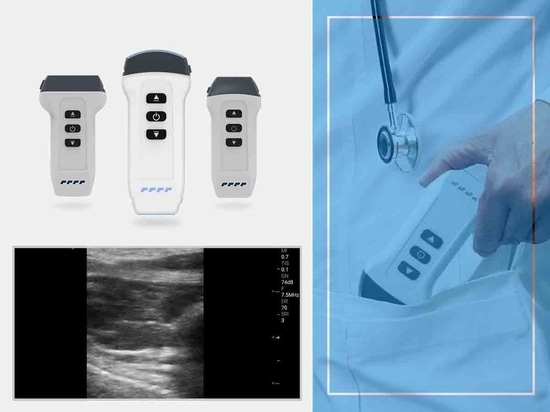 wireless handheld ultrasound machine