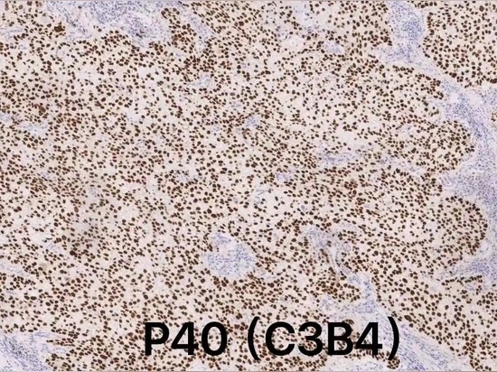 Celnovte’s CD138(C5G6) on Automatic IHC stainer CNT360 is honored as recommendation from NordiQC