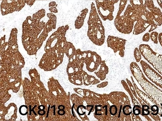 Celnovte’s CD138(C5G6) on Automatic IHC stainer CNT360 is honored as recommendation from NordiQC