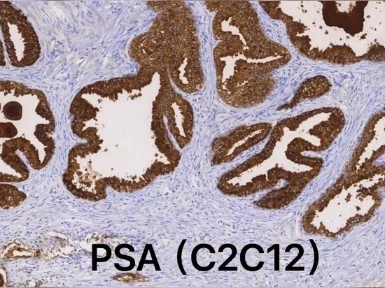 Celnovte’s CD138(C5G6) on Automatic IHC stainer CNT360 is honored as recommendation from NordiQC