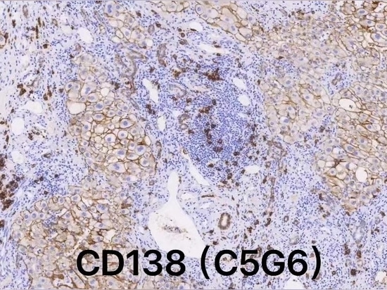 Celnovte’s CD138(C5G6) on Automatic IHC stainer CNT360 is honored as recommendation from NordiQC