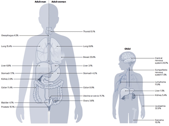 Figure 1. Organ locations of common human cancers