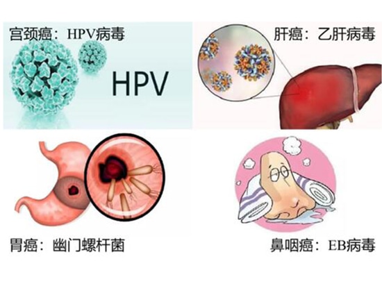 Figure 5 Pathogens and cancer