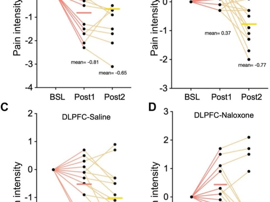 New research published using YINGCHI TMS