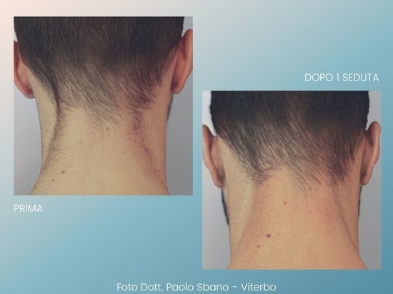 Before and After
