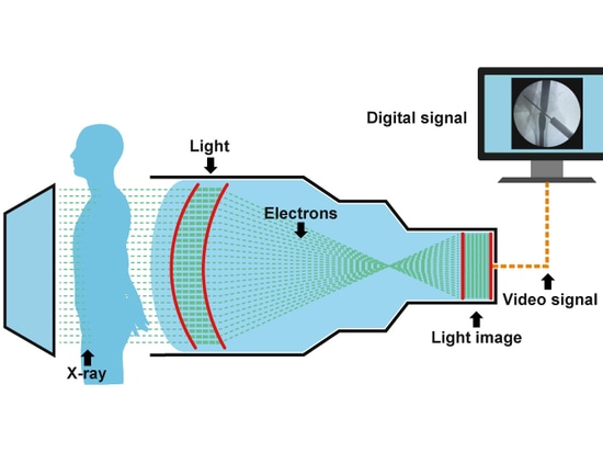 image Intensifier  Workflow