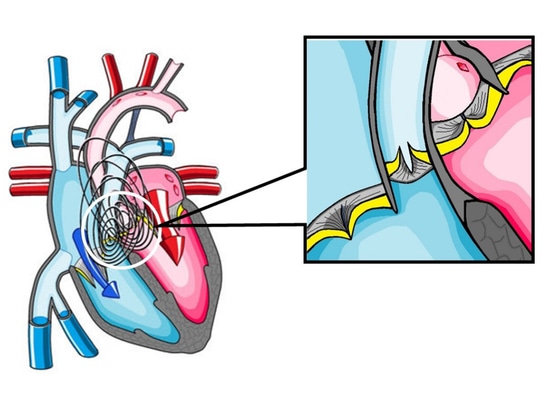 On March 9, we will listen to heart sound splitting.