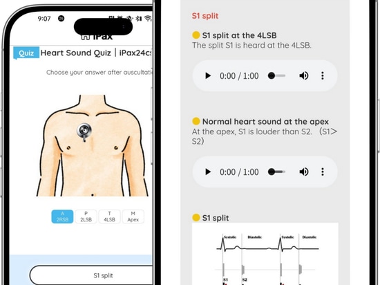 On March 10, we will have a heart sound splitting quiz.