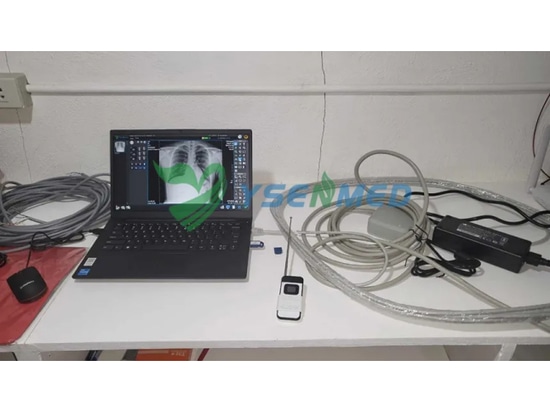 Philippinese doctors are happy with YSENMED YSX056-PE digital portable x-ray unit.