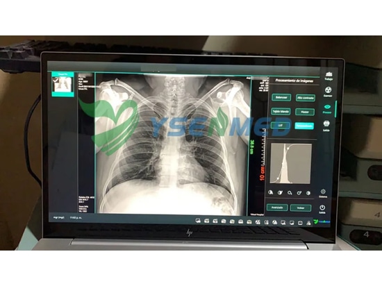Customer from Bolivia satisfied with YSENMED flat panel detector YSFPD4343A.