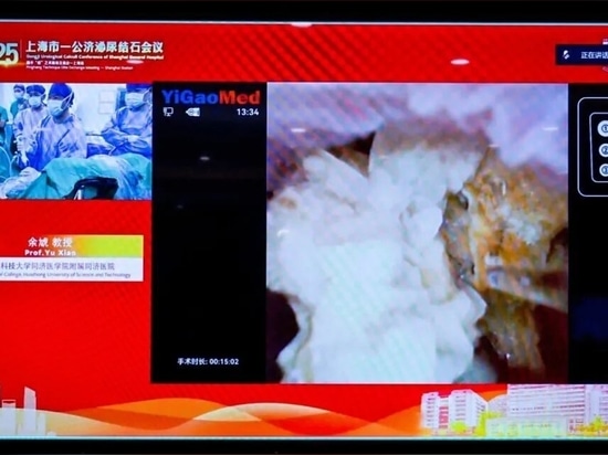 Live surgery performed by Xiao Yu