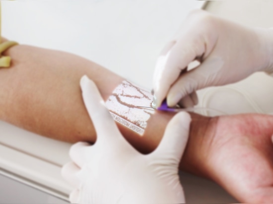How Projection Vein Finders Work in Modern Healthcare